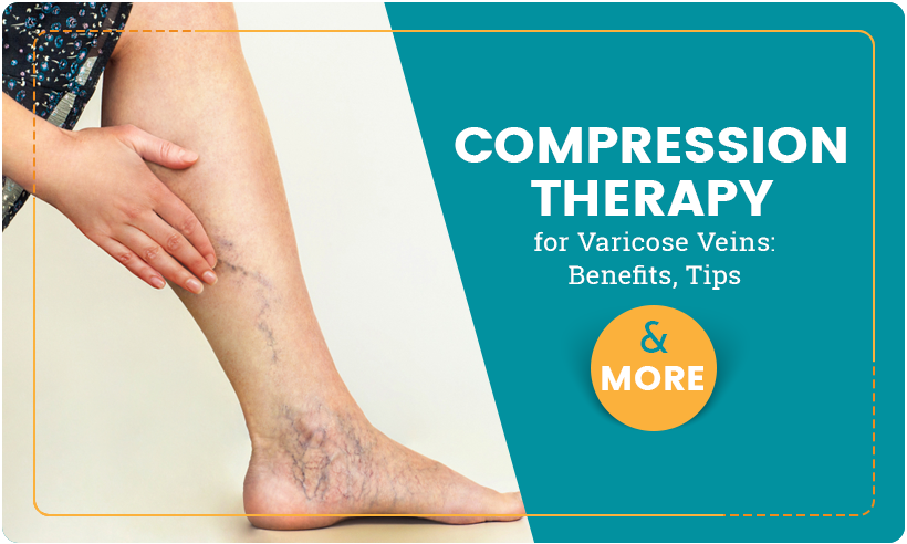 Compression Therapy for Varicose Veins: Benefits, Tips and More